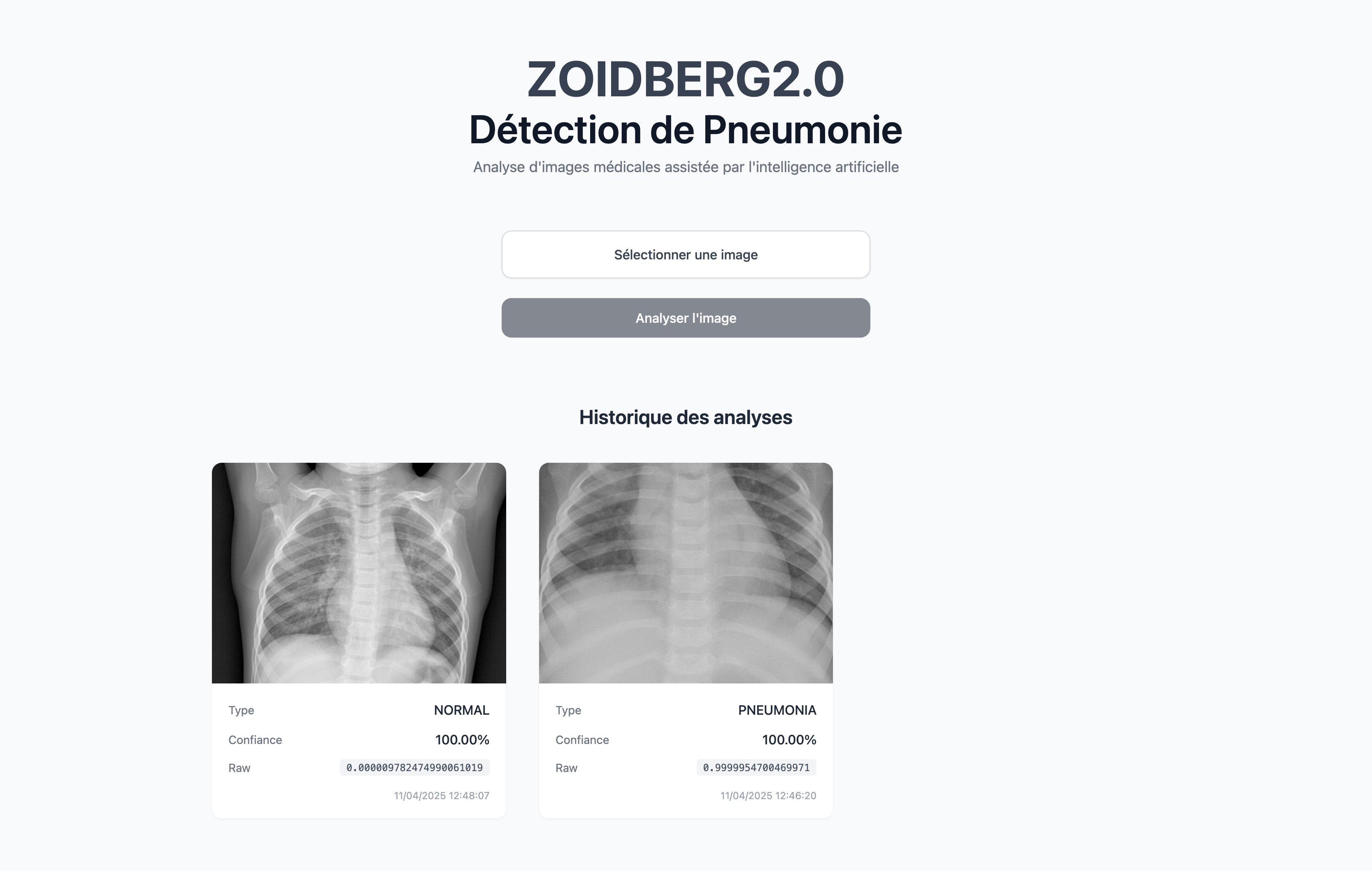 Medical-AI-Detection